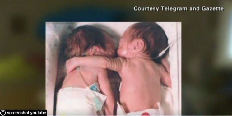 Prijevremeno rođena beba zagrlila blizankinju na samrti: Ono što se dogodilo iznenadilo je sve!