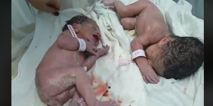 Video blizanaca rođenih u Tirani 20 minuta nakon razornog potresa raznježio javnost